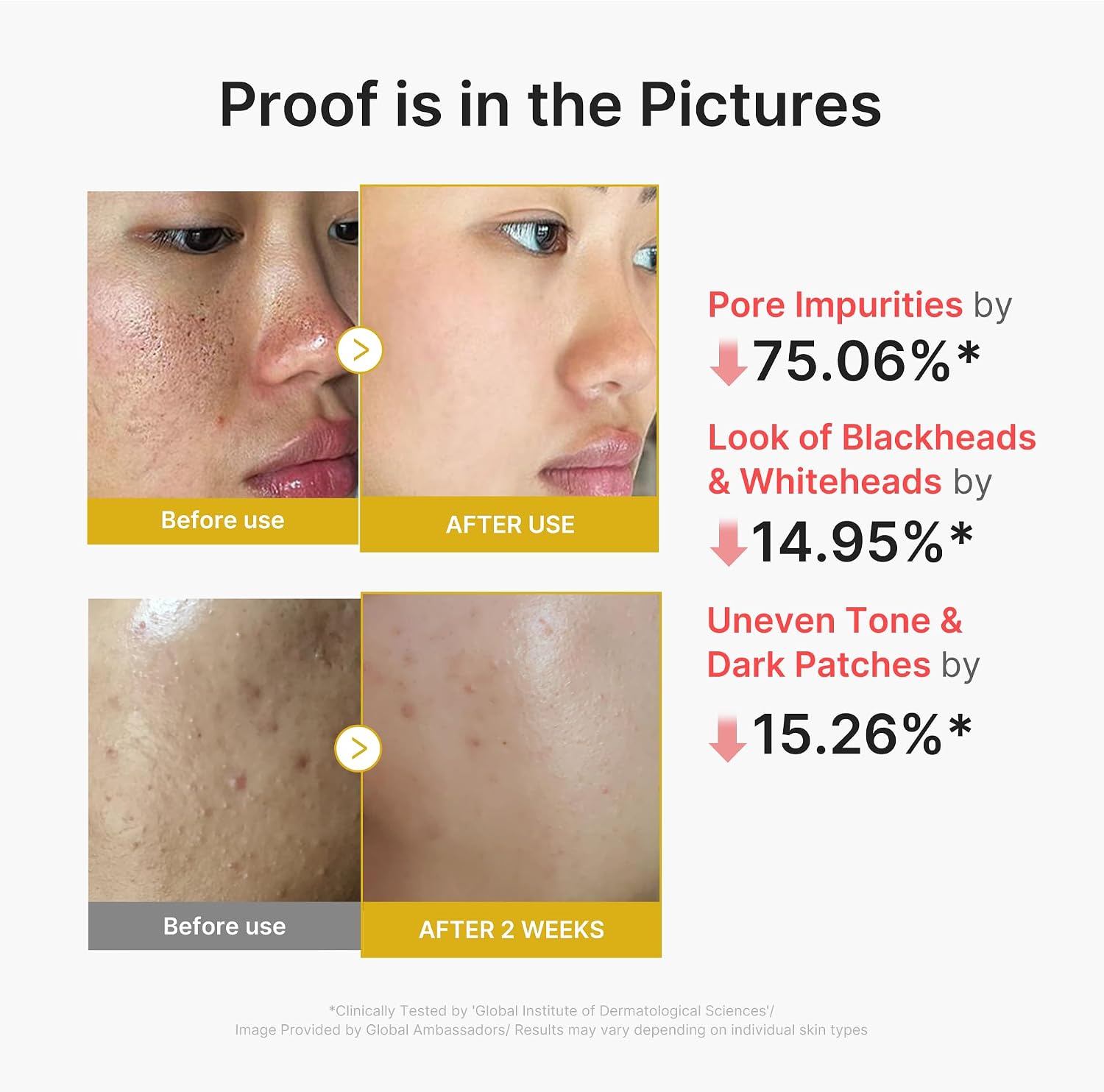 Medicube Peel Shot with Kojic Acid Turmeric for Troubled Skin 80ml - Image 2